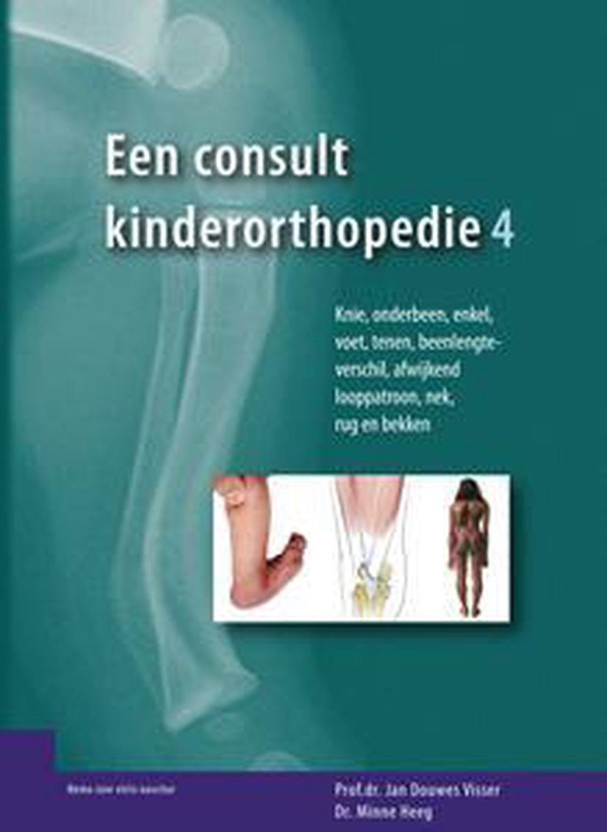 Een consult kinderorthopedie, deel 4