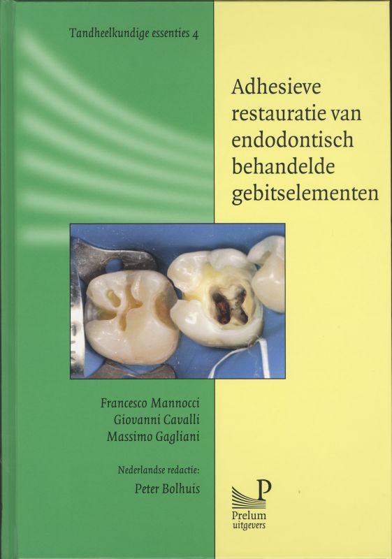 Tandheelkundige essenties 4 -   Adhesieve restauratie van endodontisch behandelde gebitselementen