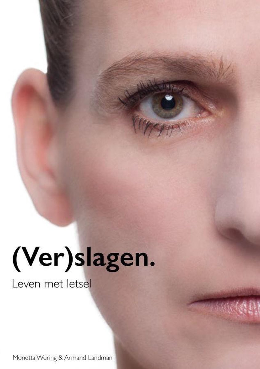 (Ver)slagen. Leven met letsel