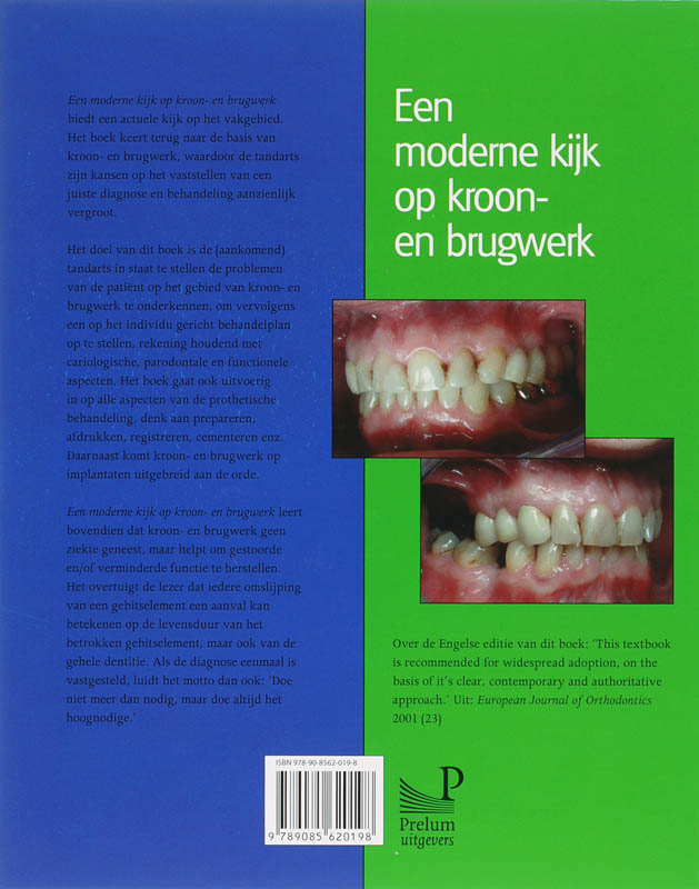 Een moderne kijk op kroon- en brugwerk achterkant