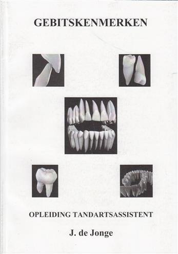 Gebitskenmerken
