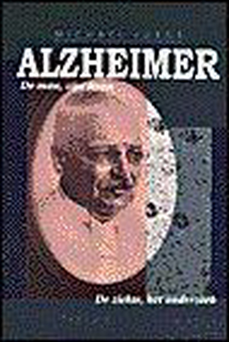 Alzheimer